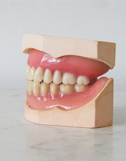 How Much Does Air Abrasion in North Long Beach Cost Image