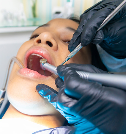 How Does Dental Abrasion Happen Image