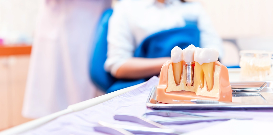Dental Implants FAQs in Bixby Knolls Image.