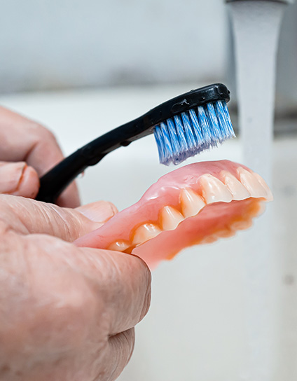 What Are Overdentures Image