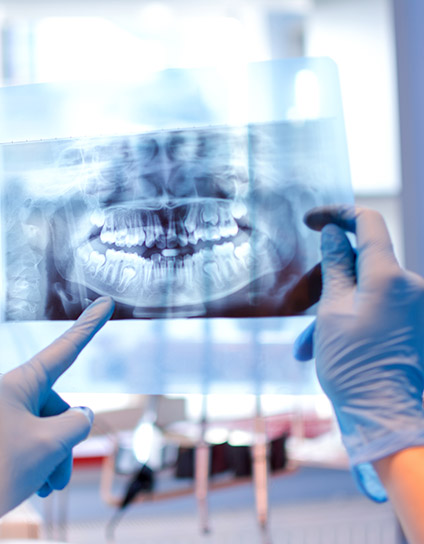 Digital X-Rays Image