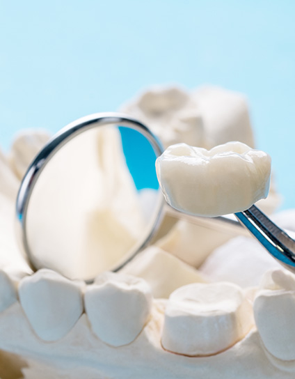 Will I Have to Get Any Teeth Extracted Before I Can Start Treatment Image