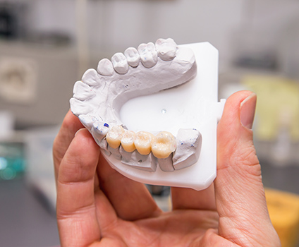 Removable Partial Denture Long Beach CA
