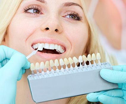 Porcelain Dental Veneers North Long Beach