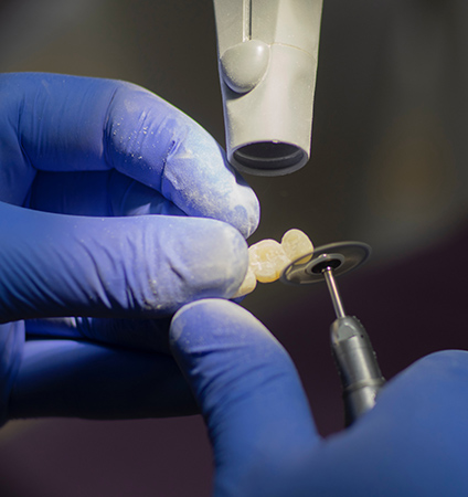 What Restorative Dental Treatments Does Your Bixby Knolls Dentist Provide Image