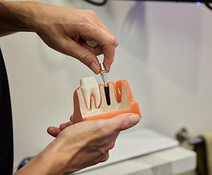 CEREC Crown Long Beach CA