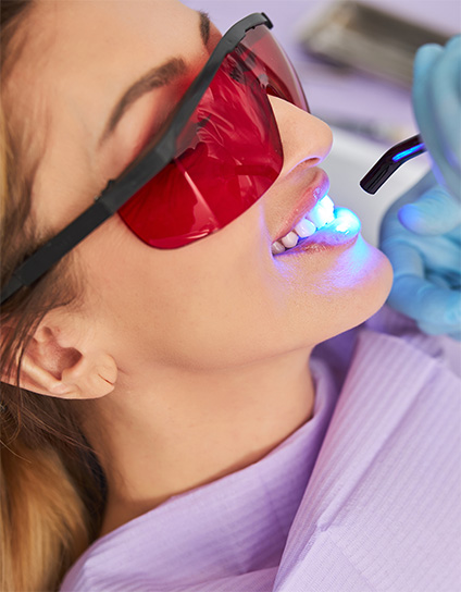 Teeth Brightening Long Beach CA Image 03