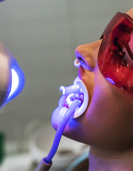 Zoom Whitening Long Beach CA