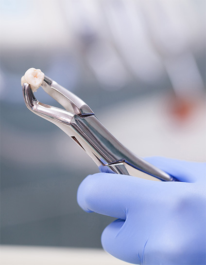 Teeth Extraction Long Beach CA